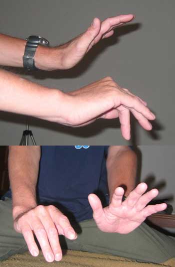 Ian's strangely curling fingers